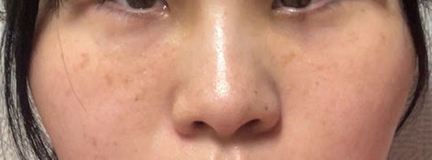 before photo: ルメッカ