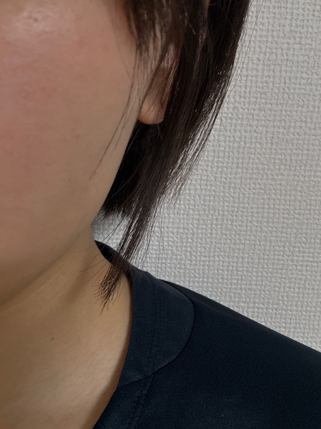 女性限定】顔脱毛｜ジェントルマックスプロ／ジェントルマックスプロ