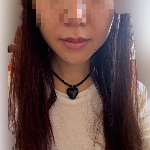 after photo: インモード