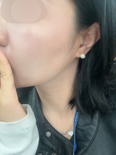 after photo: 쥬베룩