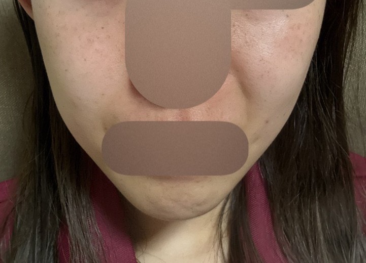 before photo: ルメッカ