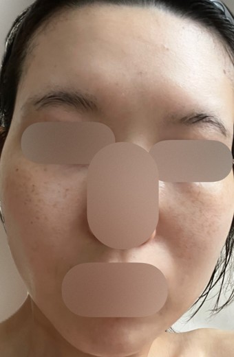 after photo: ルメッカ