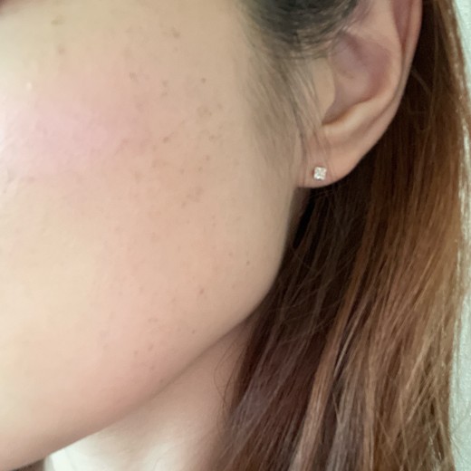 after photo: ルメッカ
