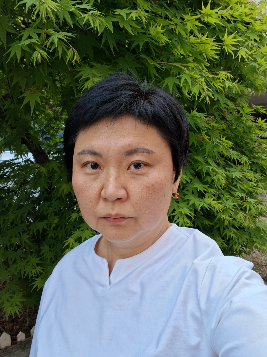 시술 후