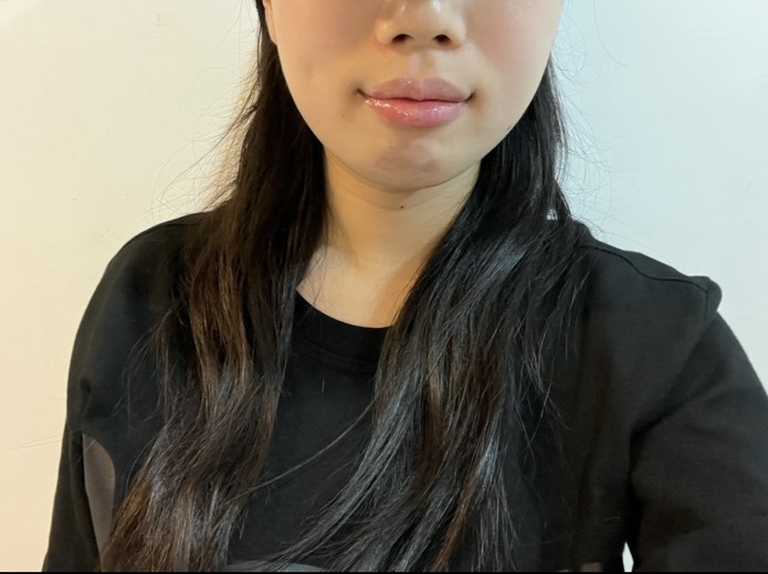 after photo: 입술필러