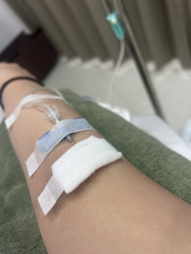 before photo: ビタミン注射・点滴