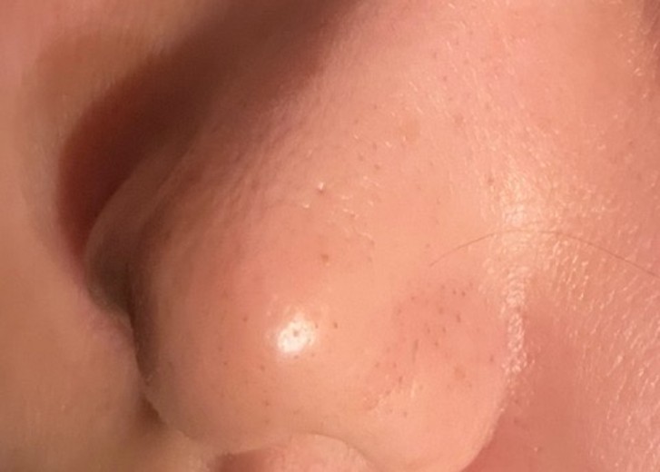 before photo: ヴェルベットスキン
