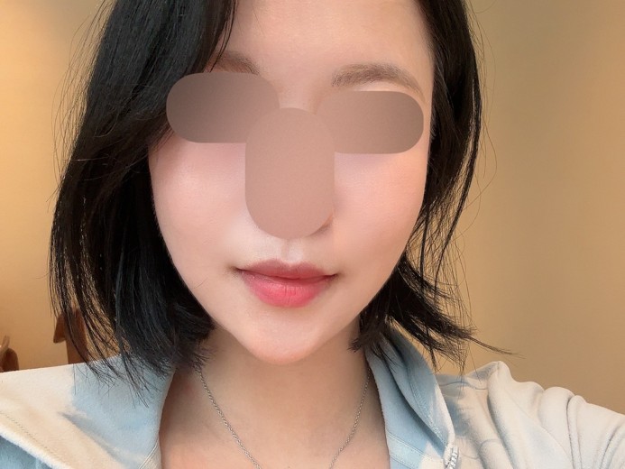 after photo: 쥬베룩