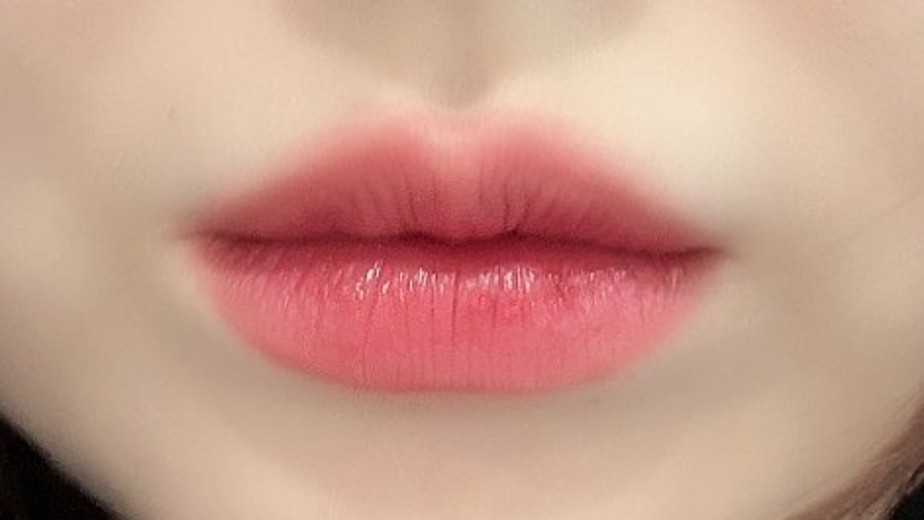 before photo: 입꼬리필러, 입술필러