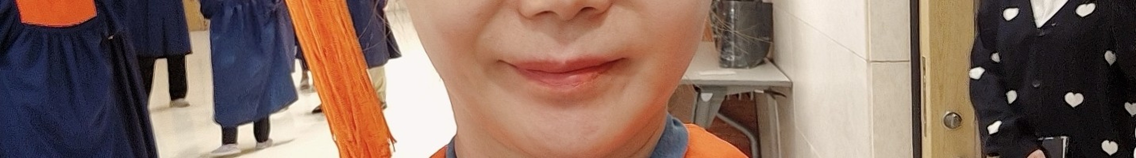 before photo: 이마필러