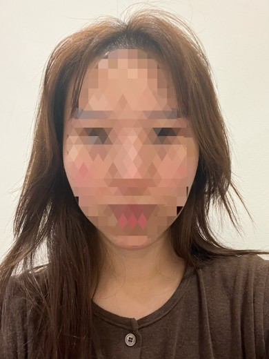 before photo: 포트라리프팅