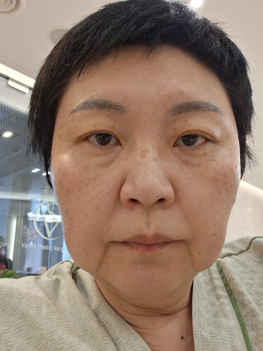 시술 전
