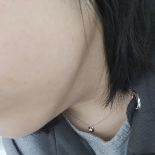 after photo: 사각턱보톡스, 튠라이너