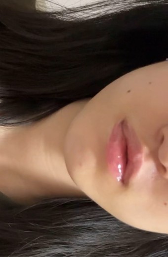 after photo: 사각턱보톡스, 슈링크유니버스