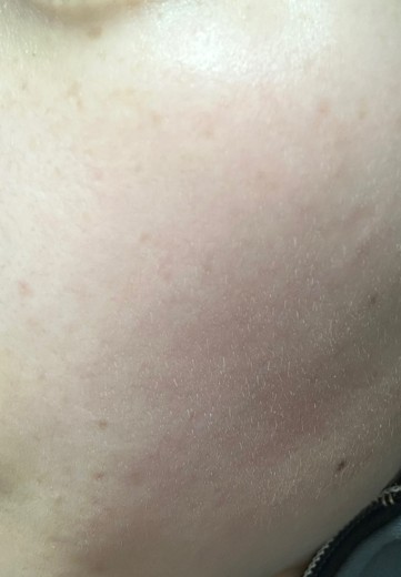 after photo: ルメッカ
