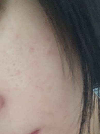 after photo: 쥬베룩