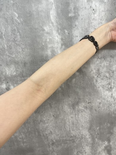 after photo: 白玉注射・点滴, ビタミン注射・点滴