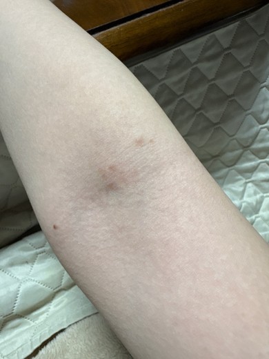 after photo: 美容注射・点滴