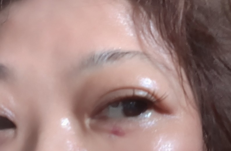 after photo: スネコス