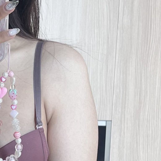 after photo: 팔지방분해주사