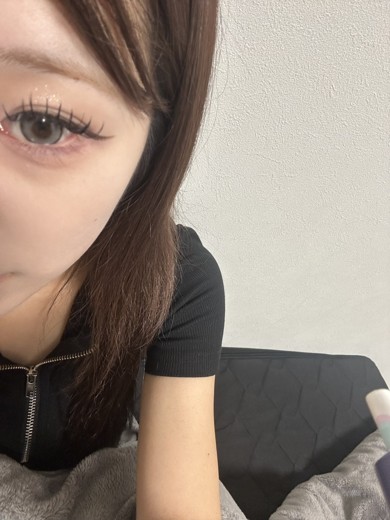 after photo: 美容注射・点滴