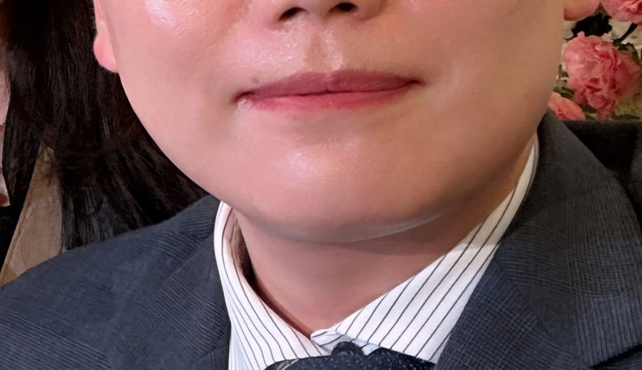 before photo: 아쿠아필링, 수염제모