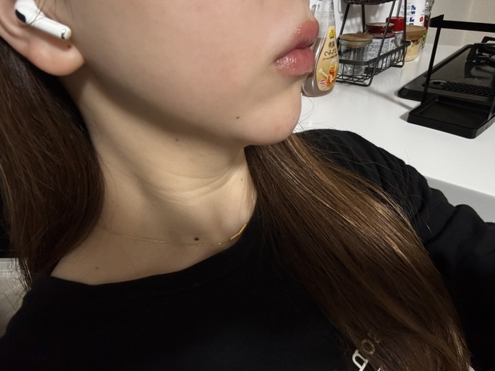 after photo: リニアファーム(ハイフ)