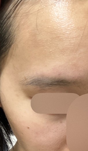 after photo: ルメッカ