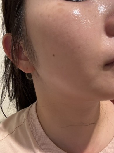 after photo: 診断・検査