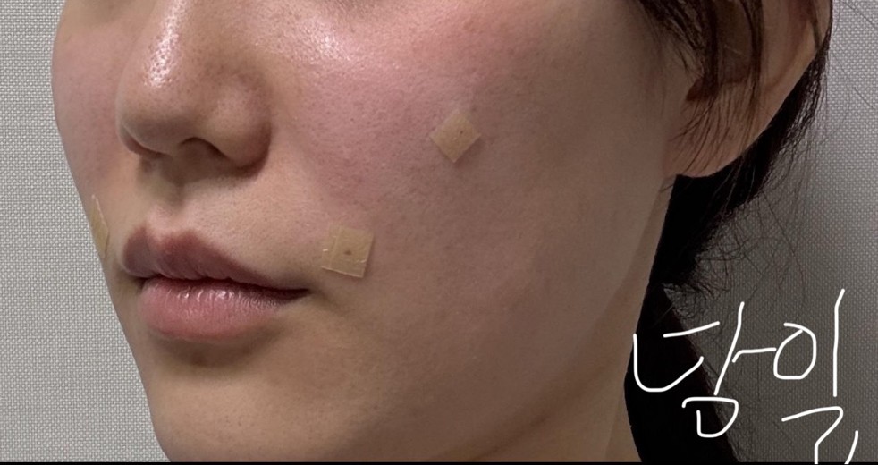 after photo: 쥬베룩