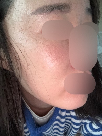 after photo: 쥬베룩