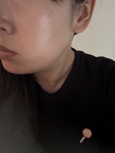 before photo: インモード