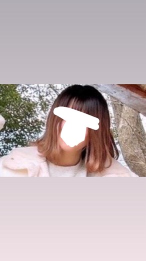 before photo: 脂肪溶解注射(顔)