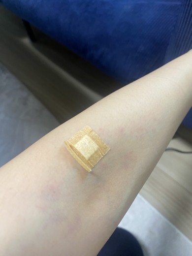 after photo: 白玉注射・点滴