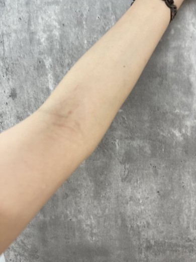 after photo: 白玉注射・点滴, ビタミン注射・点滴