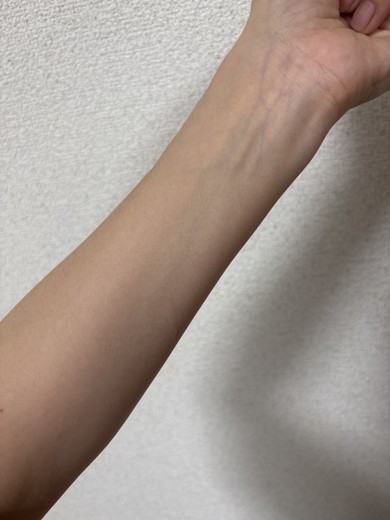 before photo: ビタミン注射・点滴