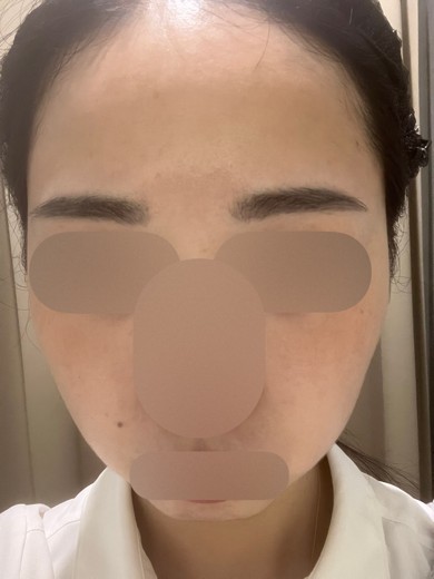 before photo: 白玉注射・点滴, ルメッカ