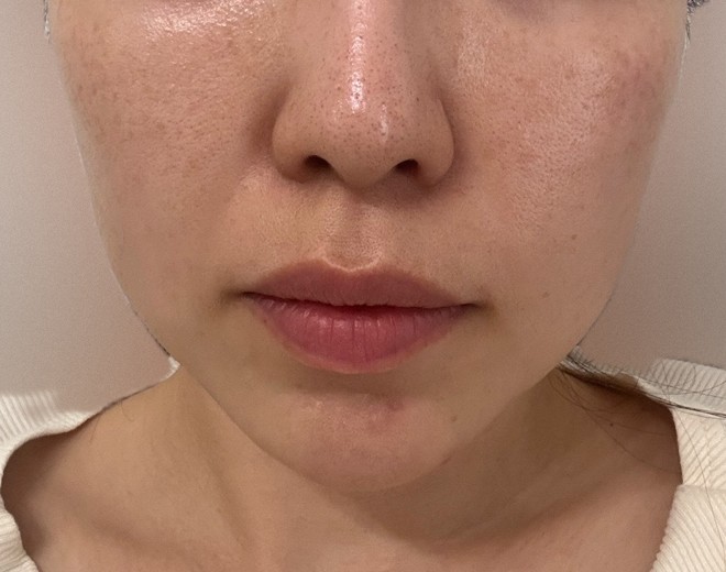 before photo: ハイフシャワー