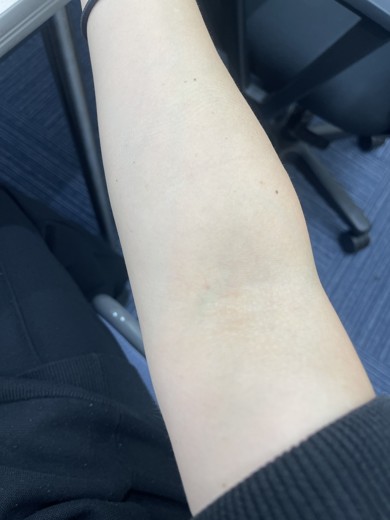 after photo: ダイエット点滴/注射