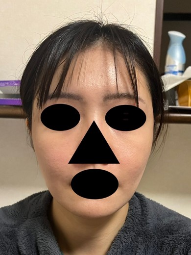 after photo: ボルニューマ