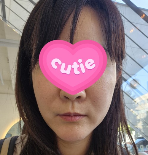 after photo: 볼필러