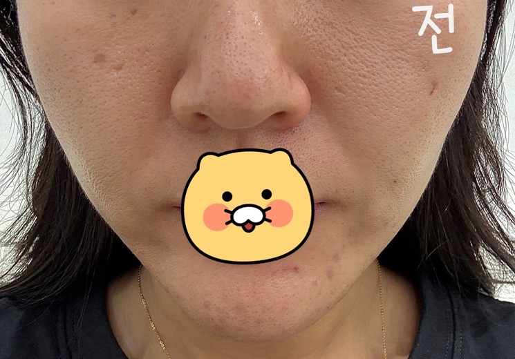 before photo: 쥬베룩