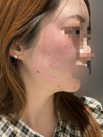 after photo: 診断・検査
