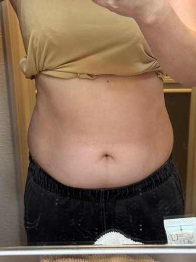 after photo: マンジャロ