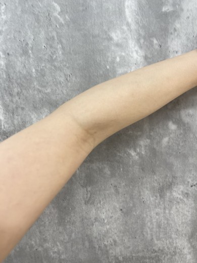 before photo: 白玉注射・点滴, ビタミン注射・点滴