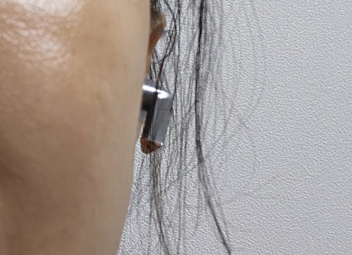 after photo: 라라필