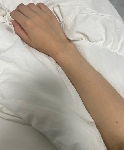 before photo: 白玉注射・点滴