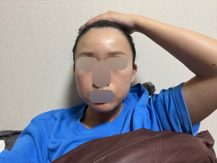 after photo: ウルトラセルZi・リニアZ(ハイフ)