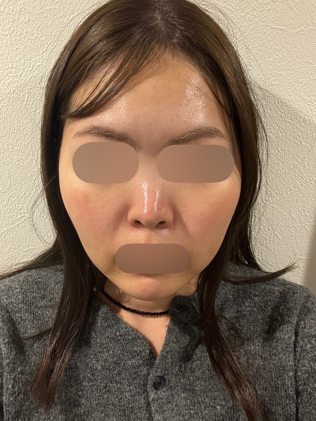 一代エレクトロポレーション　ハイドラフェイシャル 再来OK】ハイドラフェイシャル＋エレクトロポレーション | おおかみ