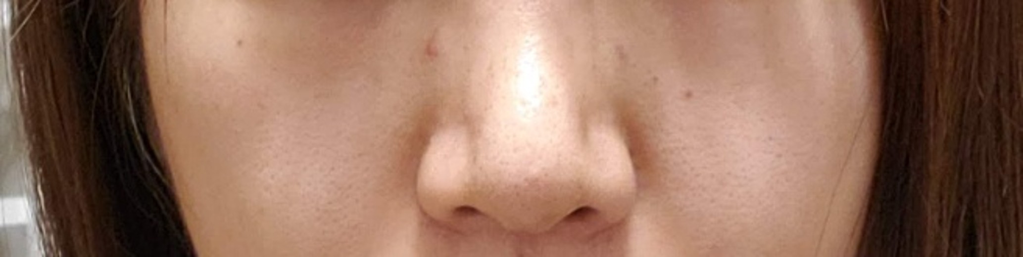 ヴェリテクリニック大阪院の施術口コミ113件, image size:2067x520